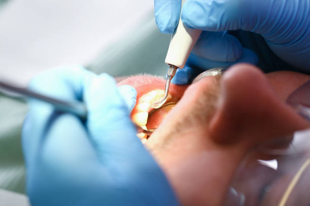 Best Broken Tooth Emergency  in North Lima, OH