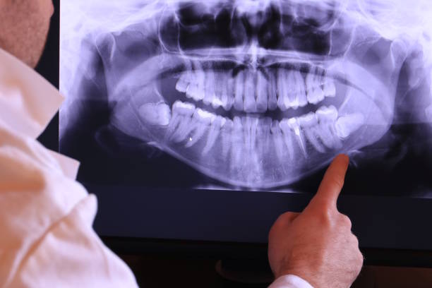Best Teeth Whitening  in North Lima, OH