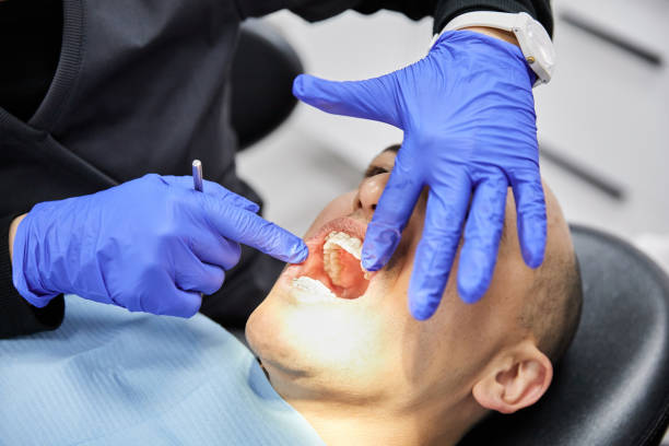Best Knocked-Out Tooth Emergency  in North Lima, OH